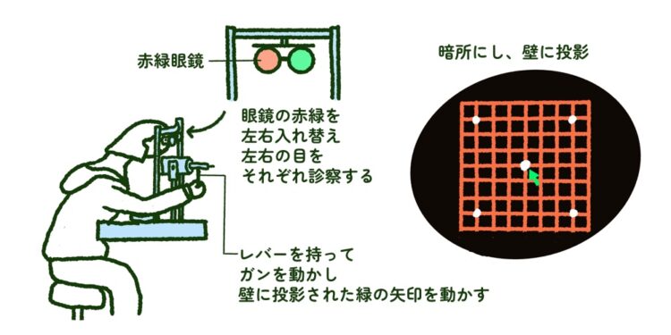眼球運転検査(ヘス赤緑試験)
